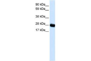 WB Suggested Anti-CAV3 Antibody Titration:  0. (Caveolin 3 抗体  (N-Term))