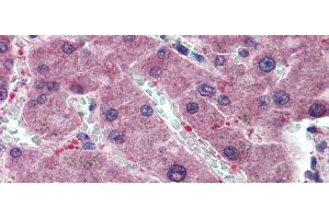 Immunohistochemistry (IHC) image for anti-Hyaluronidase-1 (HYAL1) (N-Term) antibody (ABIN2784342)