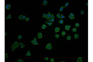 Immunofluorescence staining of HepG2 cells with ABIN7172751 at 1:100, counter-stained with DAPI. (YAP1 抗体  (AA 155-504))