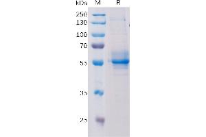 STING/TMEM173 Protein (Fc Tag)