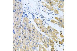 Immunohistochemistry of paraffin-embedded mouse stomach using CASP9 antibody. (Caspase 9 抗体)