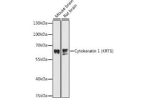 Western blot analysis of extracts of various cell lines, using Cytokeratin 1 (Cytokeratin 1 (KRT1)) antibody (ABIN6127738, ABIN6143011, ABIN6143012 and ABIN6215521) at 1:3000 dilution. (Cytokeratin 1 抗体  (AA 200-450))