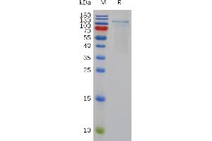 Human ADA Protein, His Tag on SDS-PAGE under reducing condition. (ADAMTS1 Protein (AA 50-967) (His tag))