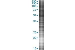 SH2D1A transfected lysate. (SH2D1A 293T Cell Transient Overexpression Lysate(Denatured))