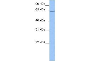 WB Suggested Anti-NOL5A Antibody Titration: 1 ug/mlPositive Control: 721_B cell lysate NOP56 is supported by BioGPS gene expression data to be expressed in 721_B (NOP56 抗体  (Middle Region))