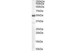 Western Blotting (WB) image for anti-Chromosome 4 Open Reading Frame 3 (C4ORF3) (Middle Region) antibody (ABIN2156498) (C4ORF3 抗体  (Middle Region))