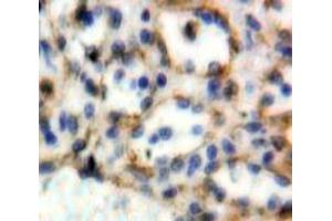 IHC-P analysis of Spleen tissue, with DAB staining. (CD72 抗体  (AA 169-359))