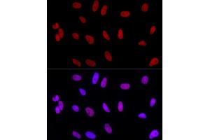 Immunofluorescence analysis of HeLa using AhR Rabbit mAb (ABIN7265679) at dilution of 1:100 (40x lens). (Aryl Hydrocarbon Receptor 抗体)