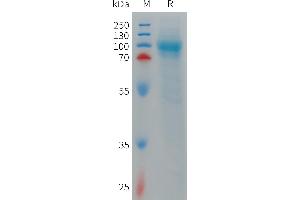 Human L Protein, His Tag on SDS-PAGE under reducing condition. (LRRN1 Protein (AA 26-630) (His tag))