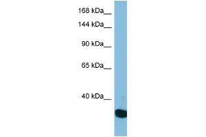 Western Blotting (WB) image for anti-Ubiquitin Specific Peptidase 36 (USP36) (N-Term) antibody (ABIN2501016) (USP36 抗体  (N-Term))