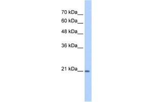 Western Blotting (WB) image for anti-Prostaglandin D2 Synthase (PTGDS) antibody (ABIN2463144) (PTGDS 抗体)