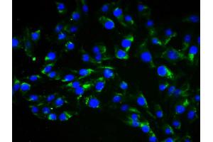 4 % Paraformaldehyde-fixed Human Umbilical Artery Endothelial Cells (HUAEC)probed with Anti-Vimentin Polyclonal Antibody, Alexa Fluor 488 conjugated (ABIN1695948) was used to stain the cell nuclei (Vimentin 抗体  (AA 371-466))