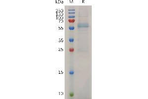 Mouse Protein, His Tag on SDS-PAGE under reducing condition. (MMP13 Protein (AA 20-148) (His tag))