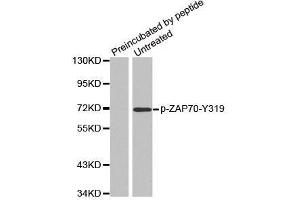 Western blot analysis of extracts from Jurkat cells, using phospho-ZAP70-Y319 antibody. (ZAP70 抗体  (pTyr319))