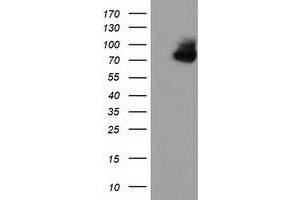 HEK293T cells were transfected with the pCMV6-ENTRY control (Left lane) or pCMV6-ENTRY OSBPL11 (Right lane) cDNA for 48 hrs and lysed. (OSBPL11 抗体)