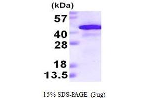 ADH1A Protein (AA 1-375) (His tag)