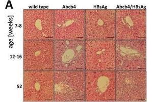 HBsAg expression elevates liver injury in Abcb4 knockout mice. (HBSAg 抗体)