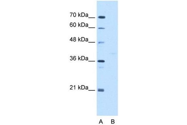 GMPPB 抗体  (C-Term)