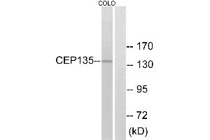 Western blot analysis of extracts from COLO cells, using CEP135 antibody. (CEP135 抗体)