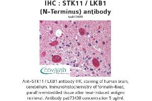 Image no. 2 for anti-serine/threonine Kinase 11 (STK11) antibody (ABIN1739721) (LKB1 抗体)