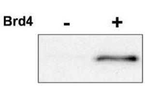 Image no. 1 for anti-Cyclin-Dependent Kinase 9 (CDK9) (pThr29) antibody (ABIN292281) (CDK9 抗体  (pThr29))