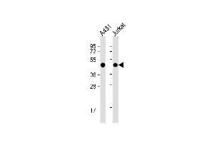 Western Blot at 1:1000 dilution Lane 1: A431 whole cell lysate Lane 2: Jurkat whole cell lysate Lysates/proteins at 20 ug per lane. (PA2G4 抗体  (AA 228-255))