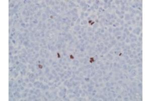 Image no. 1 for anti-Histone 3 (H3) (pSer10), (pSer28) antibody (ABIN952747) (Histone 3 抗体  (pSer10, pSer28))