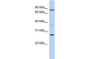 WB Suggested Anti-KLF12 Antibody Titration:  0. (KLF12 抗体  (N-Term))