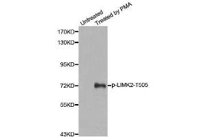 Western blot analysis of extracts from HeLa cells, using Phospho-LIMK2-T505 antibody (ABIN2988124). (LIMK2 抗体  (pThr505))