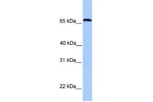 WB Suggested Anti-CCIN Antibody Titration: 0. (Calicin 抗体  (C-Term))