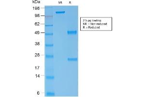 SDS-PAGE (SDS) image for anti-Spectrin alpha 1, Erythrocytic (SPTA1) (AA 356-475) antibody (ABIN6940645)