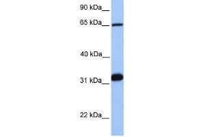 WB Suggested Anti-SF1 Antibody Titration:  0. (Splicing Factor 1 抗体  (C-Term))