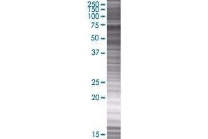 Western Blotting (WB) image for BRD3 293T Cell Transient Overexpression Lysate(Denatured) (ABIN1334035)