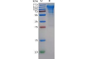 CD68 Protein (AA 22-319) (His tag)