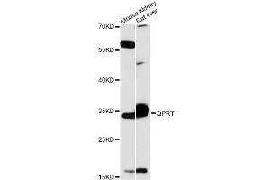 Western blot analysis of extracts of various cell lines, using QPRT antibody (ABIN6290813) at 1:3000 dilution. (QPRT 抗体)