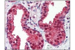 Immunohistochemistry (IHC) image for anti-Folate Hydrolase (Prostate-Specific Membrane Antigen) 1 (FOLH1) (AA 117-351) antibody (ABIN317555) (PSMA 抗体  (AA 117-351))