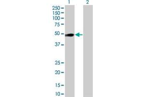 Western Blotting (WB) image for OSMR 293T Cell Transient Overexpression Lysate(Denatured) (ABIN1334429)