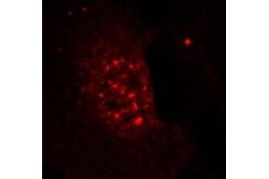 Image no. 3 for anti-V-Akt Murine Thymoma Viral Oncogene Homolog 1 (AKT1) (pThr308) antibody (ABIN196711) (AKT1 抗体  (pThr308))