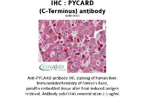 Image no. 1 for anti-PYD and CARD Domain Containing (PYCARD) (C-Term) antibody (ABIN1738638) (PYCARD 抗体  (C-Term))