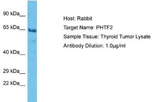 Host: Rabbit Target Name: PHTF2 Sample Type: Thyroid tumor lysates Antibody Dilution: 1. (PHTF2 抗体  (C-Term))