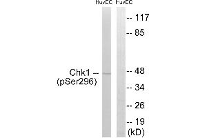 Immunohistochemistry analysis of paraffin-embedded human brain tissue using Chk1 (Phospho-Ser296) antibody. (CHEK1 抗体  (pSer296))
