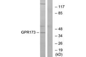 Western blot analysis of extracts from K562 cells, using GPR173 Antibody. (GPR173 抗体  (AA 251-300))