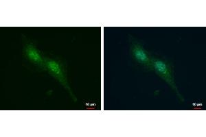 Immunofluorescence (IF) image for anti-Androgen Receptor (AR) (N-Term) antibody (ABIN2857043)