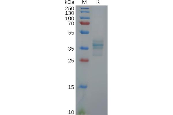 Gastrin Protein (GAST) (AA 22-92) (Fc Tag)