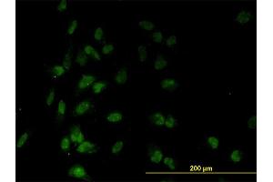 Immunofluorescence (IF) image for anti-TAF7 RNA Polymerase II, TATA Box Binding Protein (TBP)-Associated Factor, 55kDa (TAF7) (AA 130-224) antibody (ABIN563086)