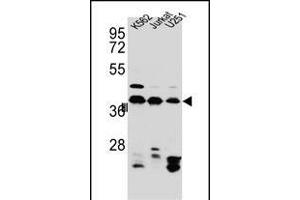 HNRNPC Antibody (C-term) (ABIN654685 and ABIN2844378) western blot analysis in Jurkat,K562, cell line lysates (35 μg/lane). (HNRNPC 抗体  (C-Term))