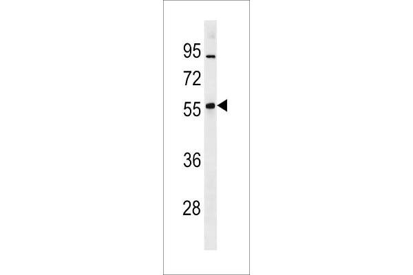 ZNF260 抗体  (N-Term)