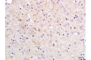 Formalin-fixed and paraffin embedded rat brain tissue labeled with Anti-APOE4/Apolipoprotein E4 Polyclonal Antibody, Unconjugated (ABIN708746) at 1:200 followed by conjugation to the secondary antibody (APOE 抗体  (AA 101-200))