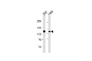 Lane 1: 293 Cell lysates, Lane 2: HeLa Cell lysates, probed with MSH2 (1184CT1. (MSH2 抗体)
