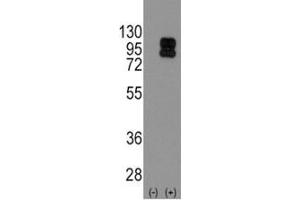 Western blot analysis of CD19 antibody and 293 cell lysate (2 ug/lane) either nontransfected (Lane 1) or transiently transfected with the CD19 gene (2). (CD19 抗体  (AA 143-172))